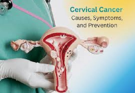 Cervical cancer in women in India: causes, prevention and need for vigilance