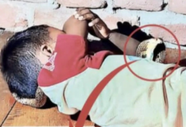 Patna News: Snake wrapped around child's neck; family held their breath for hours; the little one emerged safe and unhurt